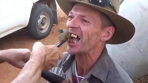 拔牙视频,揭秘拔牙全过程