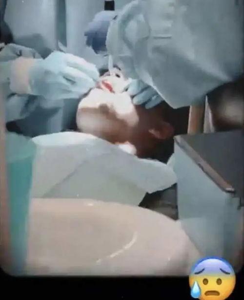 拔牙视频,揭秘拔牙全过程