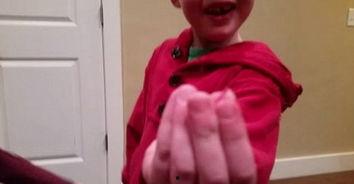 拔牙视频,揭秘拔牙全过程