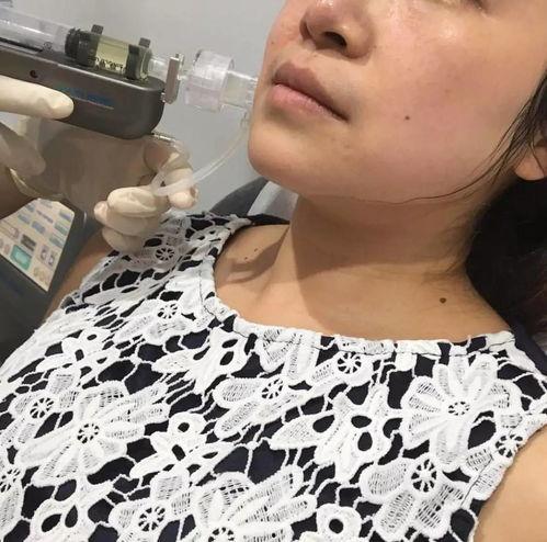 大v线雕视频,揭秘面部轮廓重塑的神奇魔法